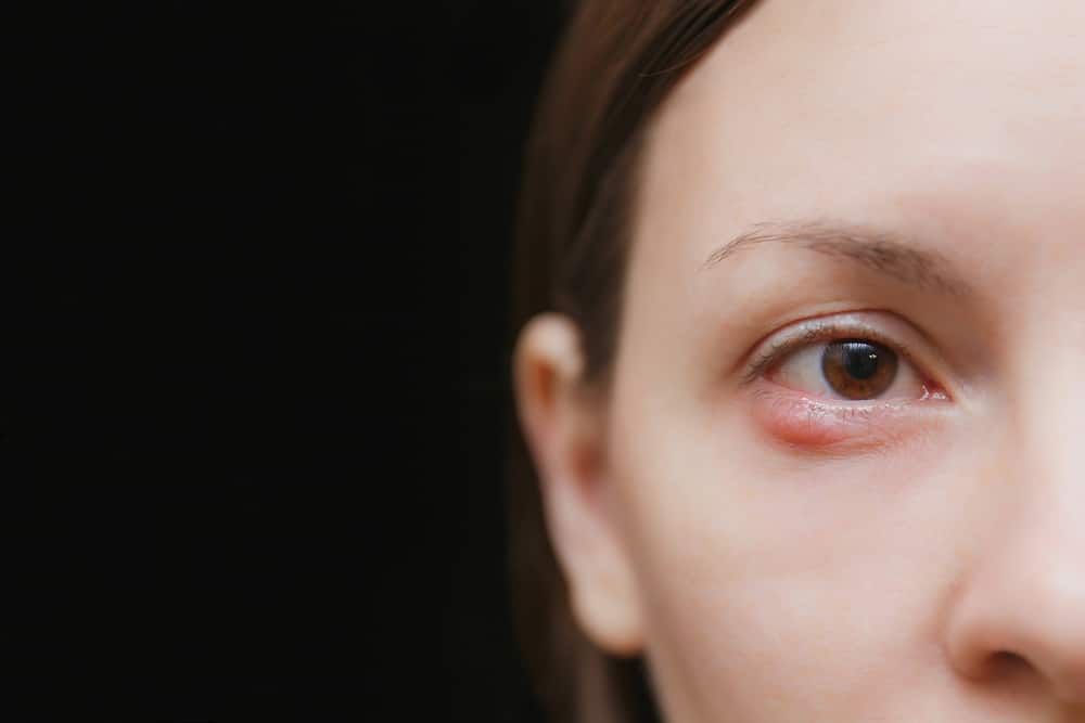 눈에 다래끼를 없애는 효과적인 방법 5가지, 무엇인가요?
