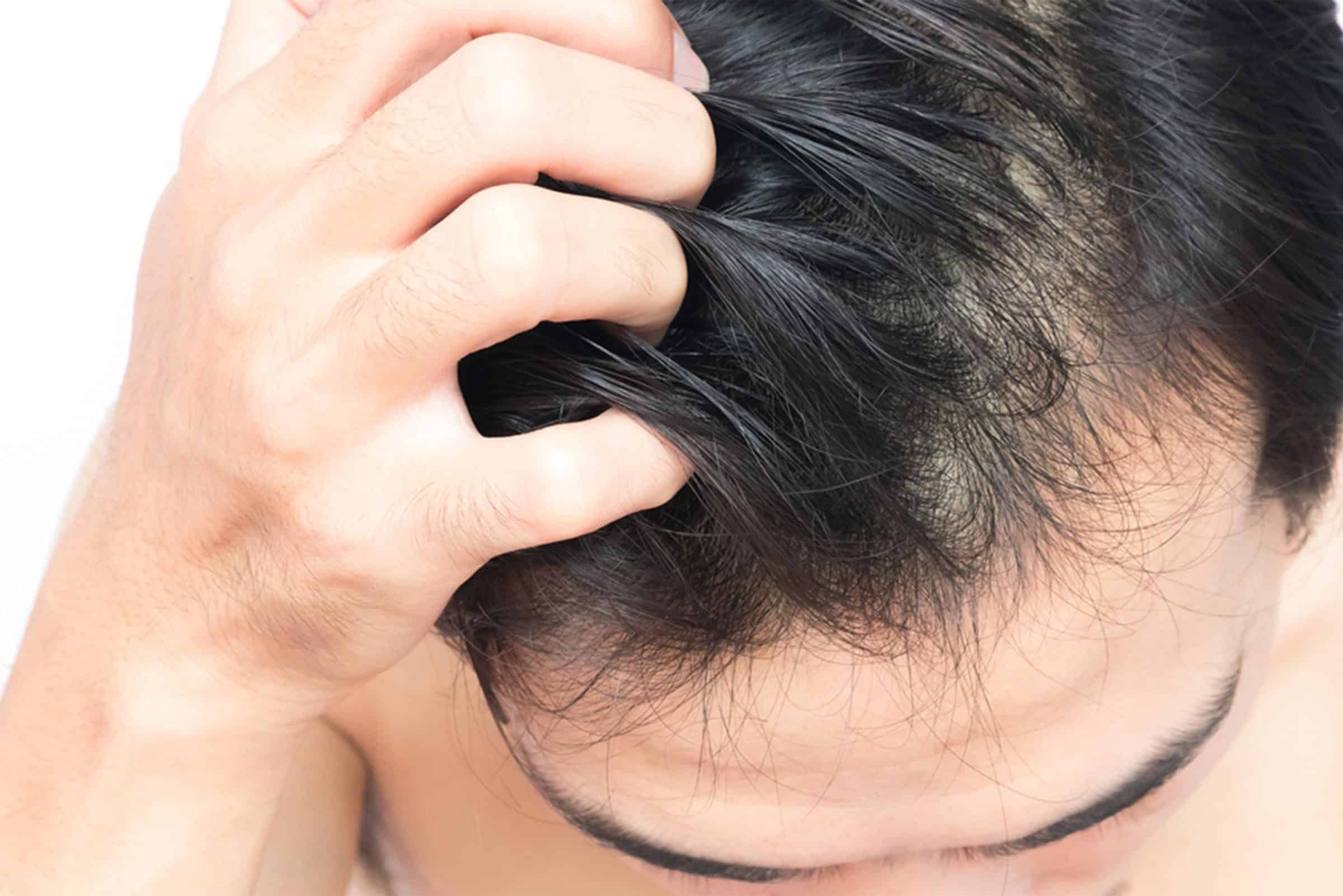 머리에 돌기가 생기는 8가지 원인: 여드름에서 피부암 징후까지