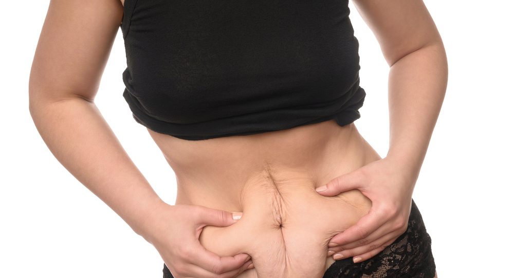 5 sposobów na zmniejszenie żołądka po cesarskim cięciu