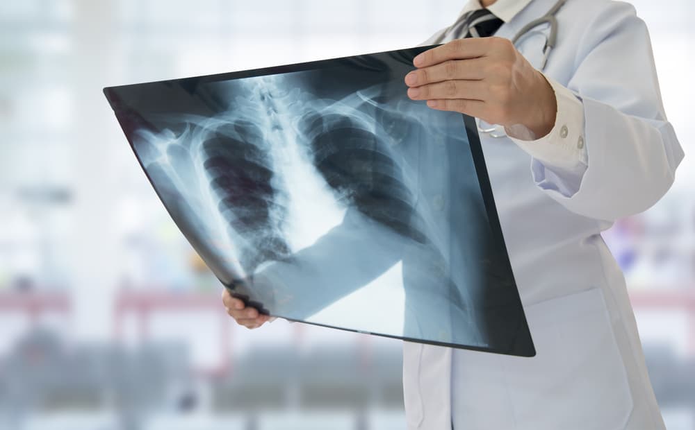 8 síntomas de los pulmones húmedos que no deben subestimarse