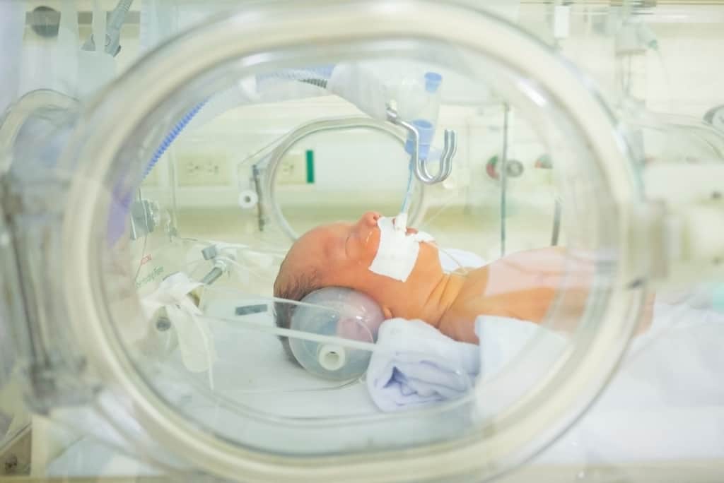 Zaskia Mecca의 아이는 신생아(TTN)의 일과성 빈호흡을 가지고 있습니다, 그것은 무엇입니까?