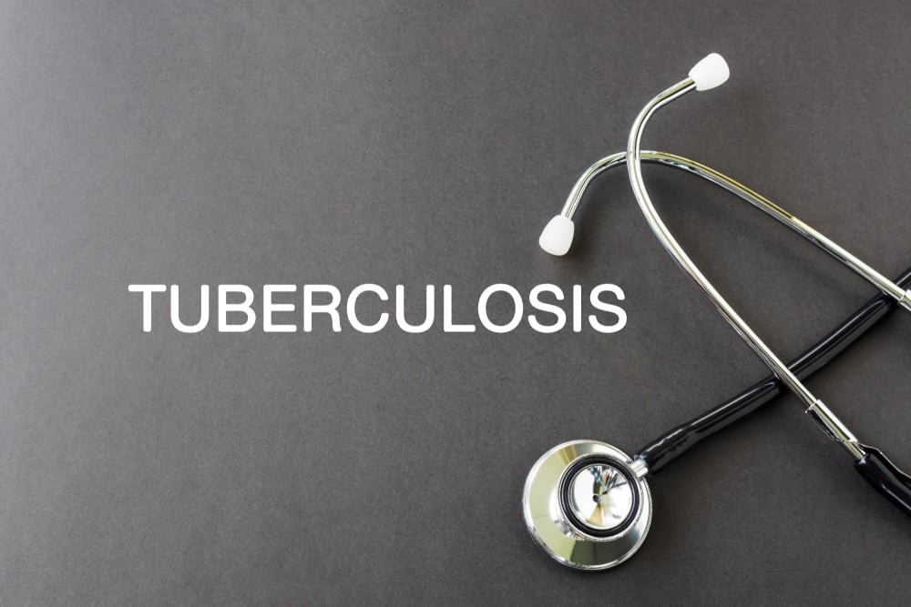 ¿Es contagiosa la tuberculosis cerebral? Así es como se propagan las bacterias desencadenantes