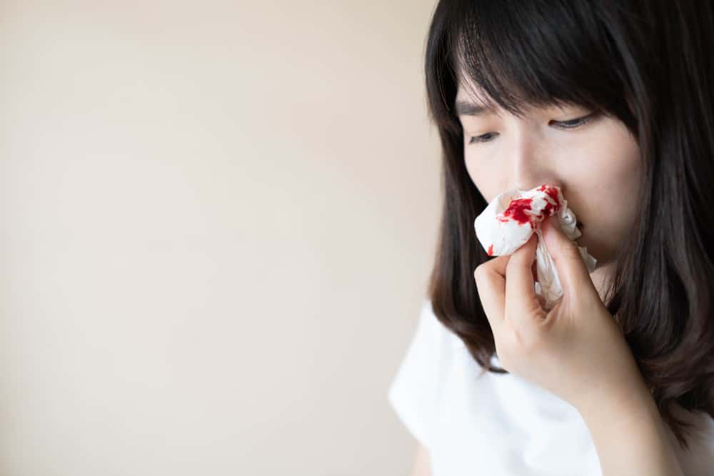 Różne przyczyny częstych krwawień z nosa u dzieci i dorosłych