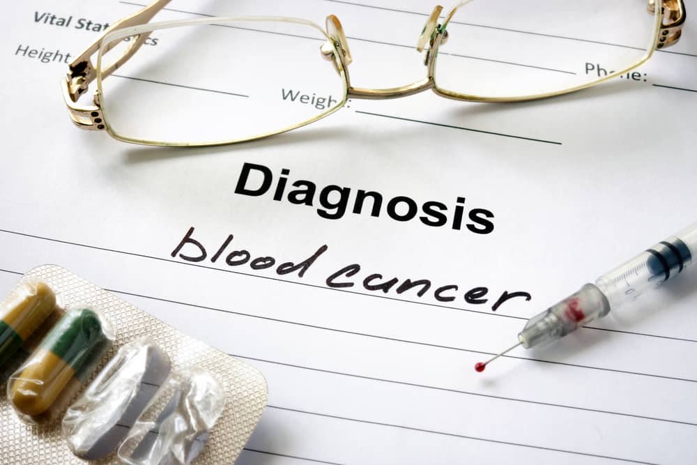 Vous devez savoir que ce sont les causes du cancer du sang dont vous devez vous méfier