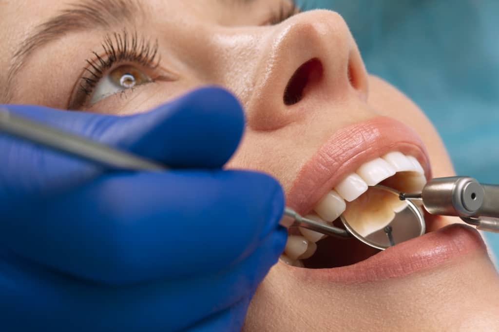 Ist es gefährlich, wenn Zahnfüllungen verschluckt werden? Lassen Sie uns mehr vollständige Fakten lesen!