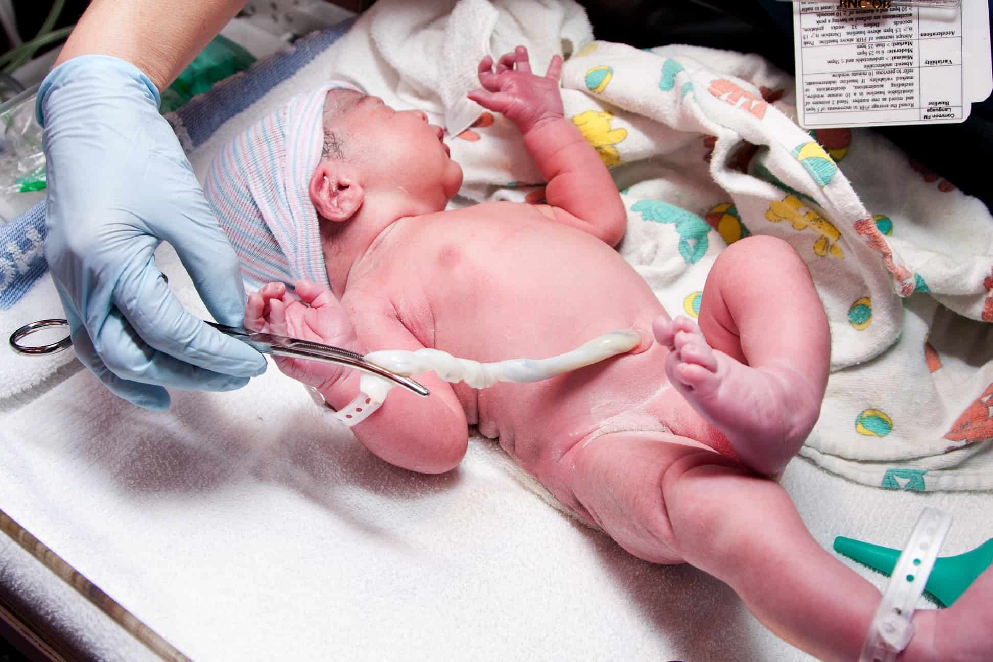 Bebeluș blocat în cordonul ombilical? Haide, cunoaște cauzele și caracteristicile
