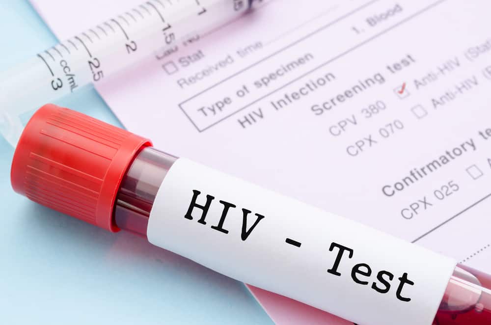 HIV și SIDA