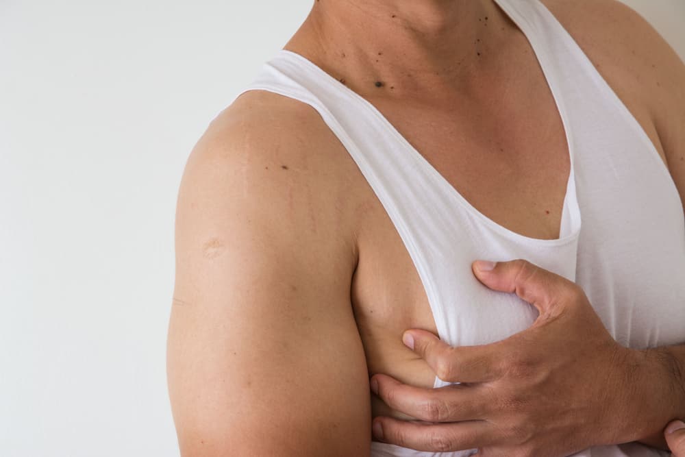 Lär känna gynekomasti: stor brösttillväxt hos män
