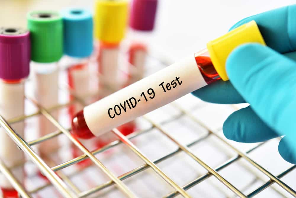 COVID-19에 대한 실험실 기반 혈청 검사 알아보기