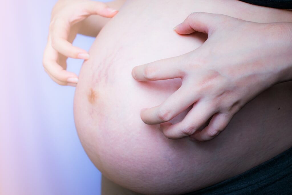 Picazón de estómago durante el embarazo: causas y la forma correcta de superarla