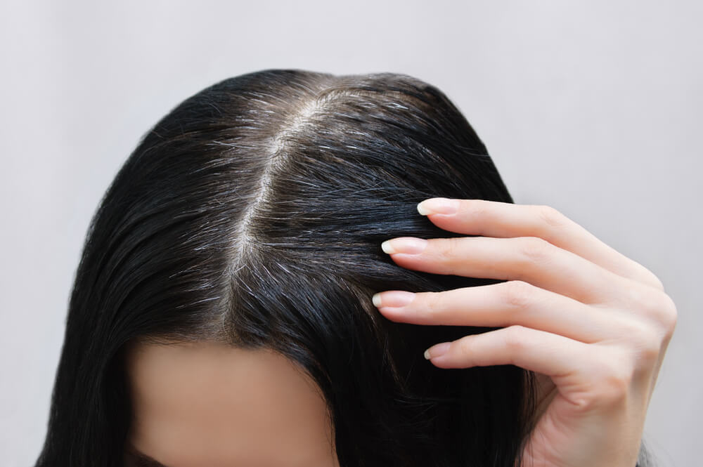 Tipuri de alimente pentru a preveni creșterea părului gri și pentru a menține strălucirea părului, care sunt acestea?