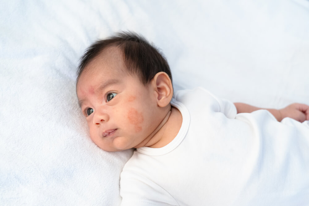 Les bébés peuvent-ils être allergiques au lait maternel ? Voici l'explication !