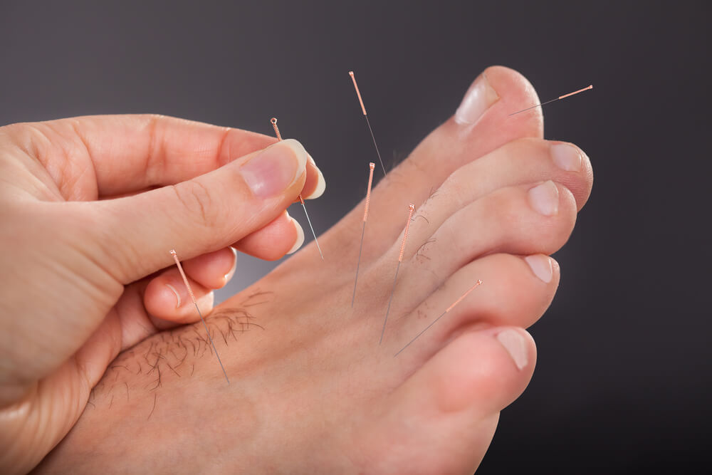 Pratiqué depuis des milliers d'années, voici les points d'acupuncture sur les pieds que vous devez connaître !