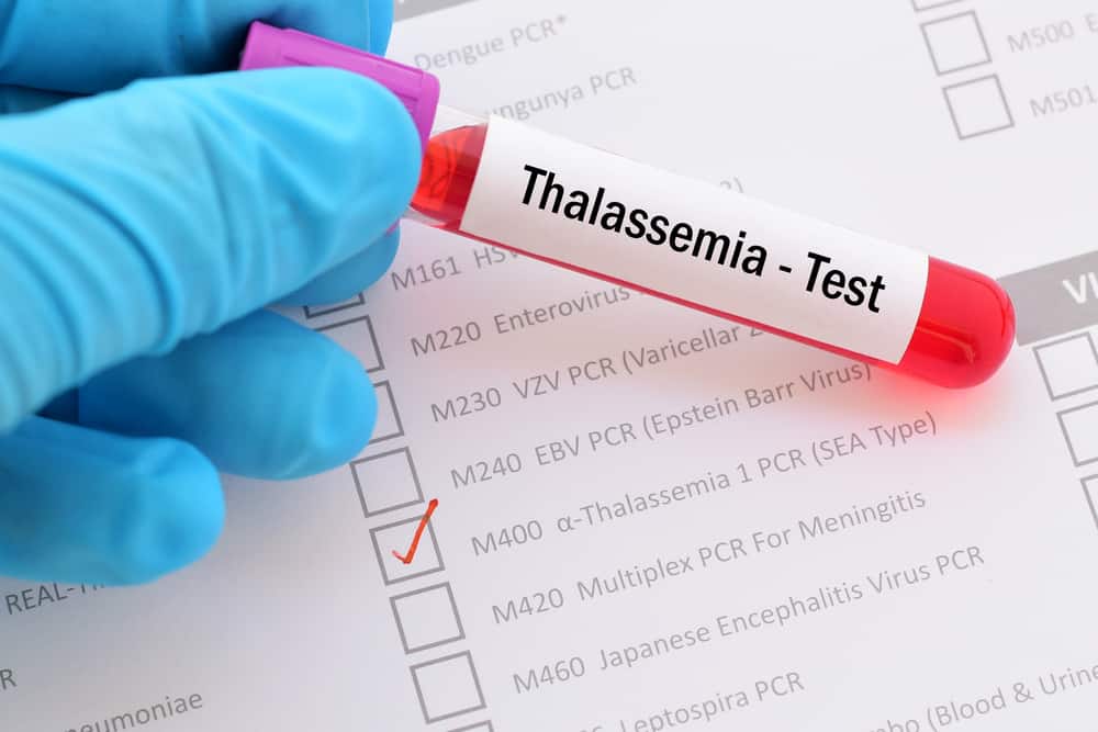Распознавание талассемии: заболевания крови, вызванные наследственными факторами